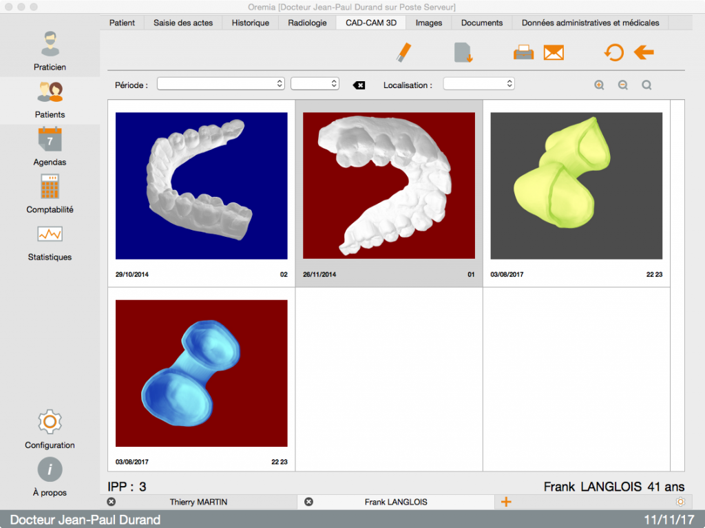 fenêtre CAD CAM 3D visualisation 3D fichier STL dans Oremia