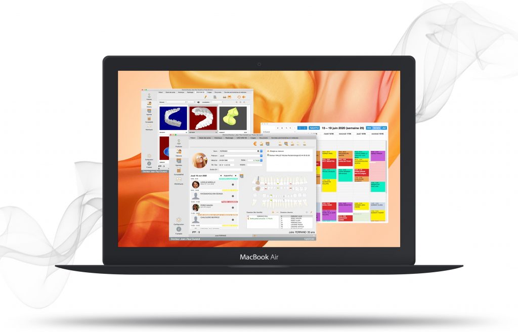 MacBook Air screen Oremia CAD CAM 3D dossier patient et Agenda